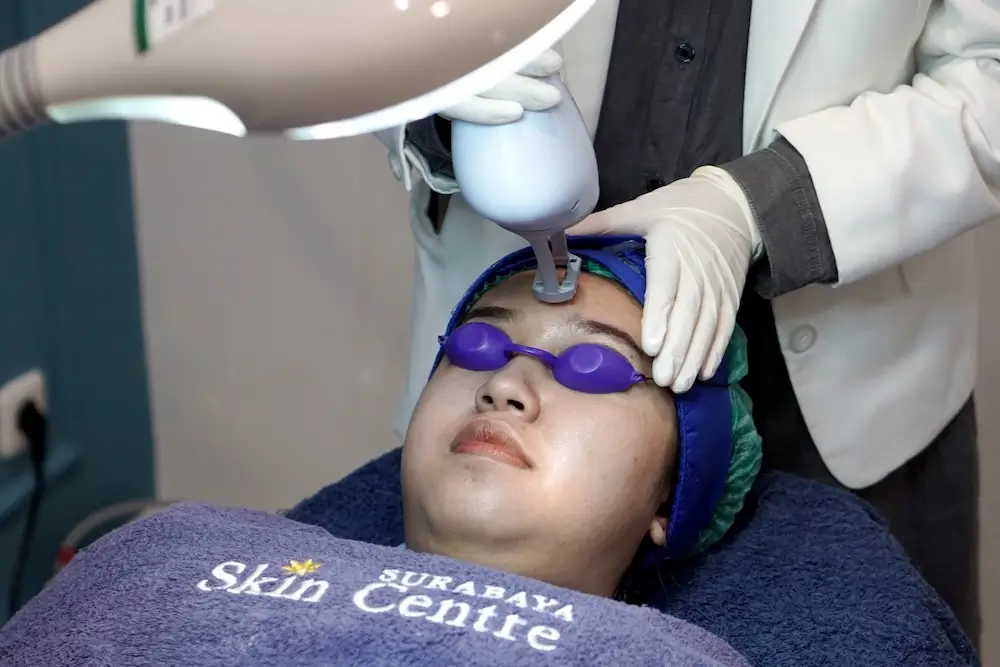 Klinik Dermatologi Perawatan Kulit Terbaik di Surabaya: Daftar Lengkap dan Review Jujur