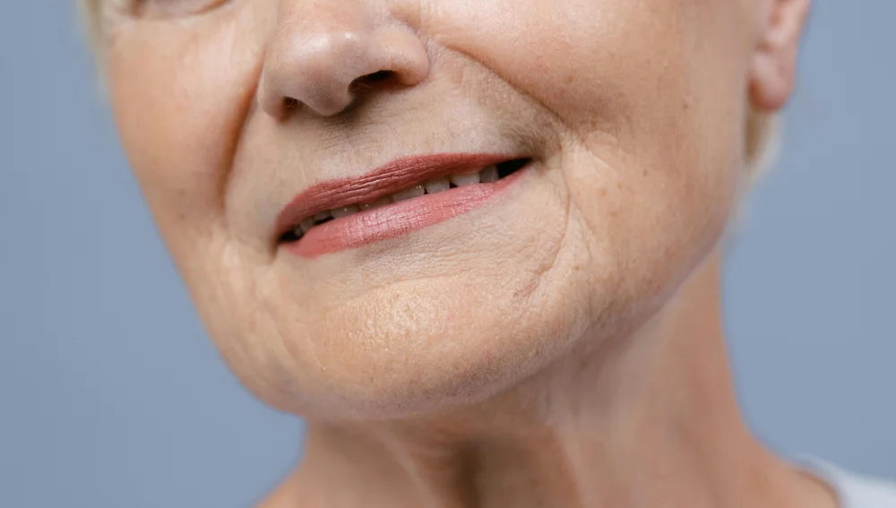 Perawatan laser anti aging untuk mengatasi penuaan dini pada kulit bibir di Surabaya Skin Centre