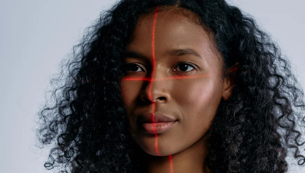 Perawatan laser untuk mengatasi kelainan kulit pada wajah - Surabaya Skin Centre