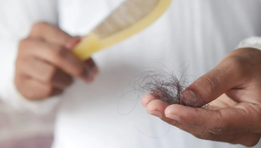 solusi medis rambut rontok berlebih di klinik kulit Surabaya