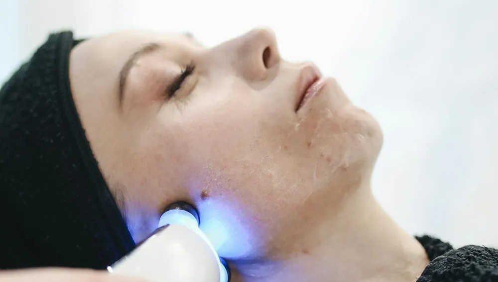 vampire rejuvenation PRP - terapi Platelet Rich Plasma untuk peremajaan kulit dan rambut di Surabaya Skin Centre oleh dr. Irmadita