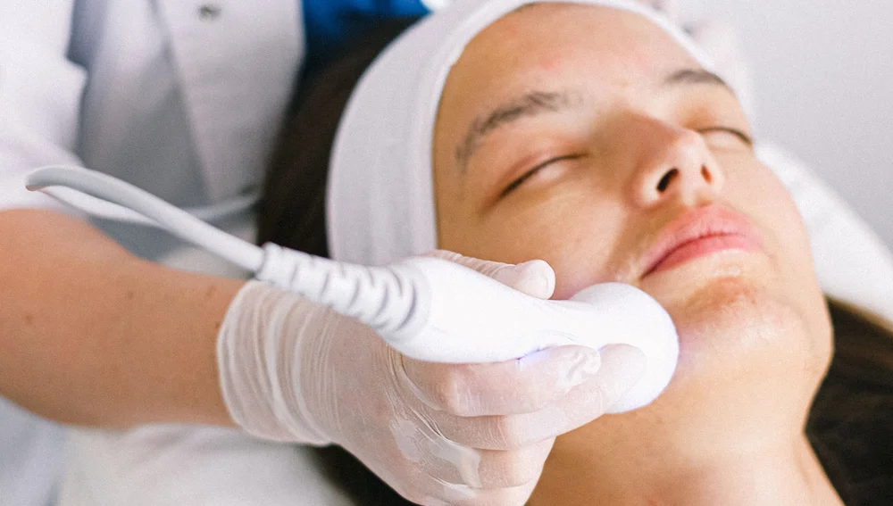 Treatment HIFU facial di Surabaya Skin Centre